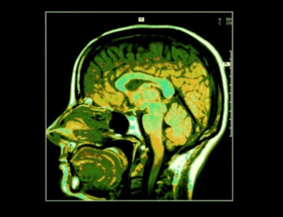 El cerebro consciente